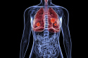 Do you know much about lung cancer?