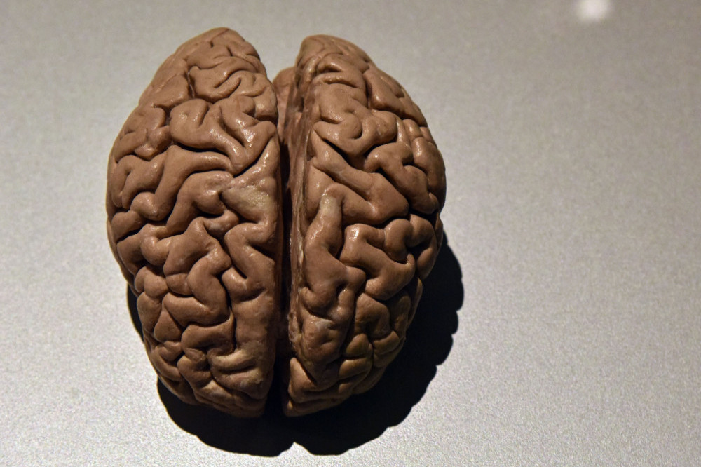 Human brains are still better than robots