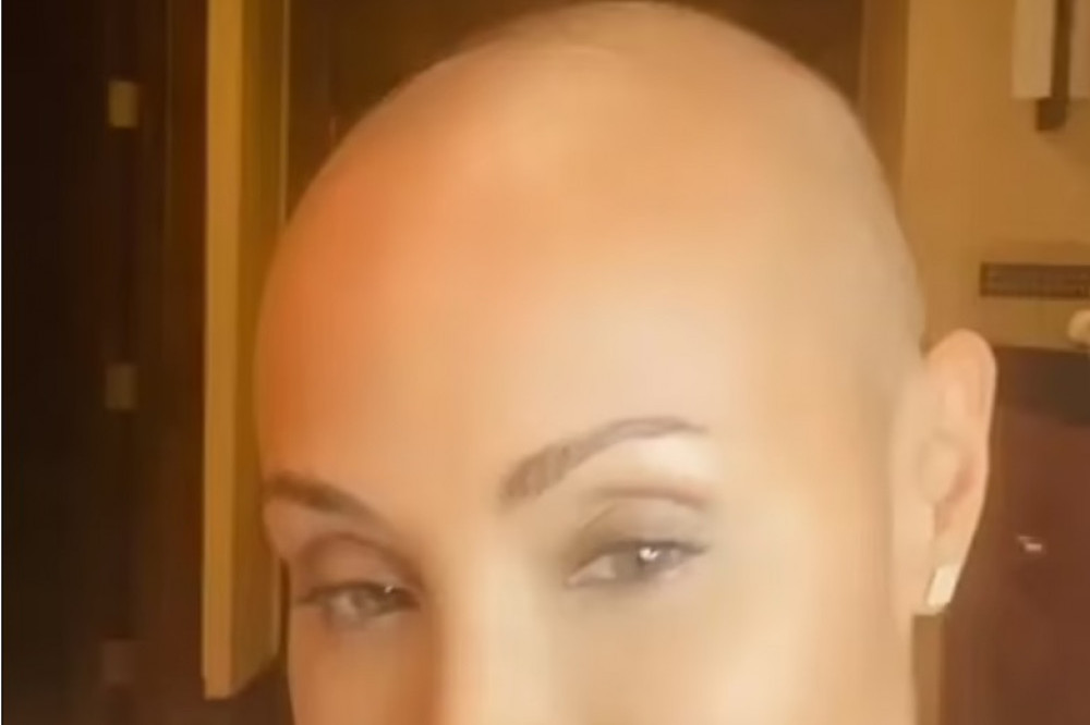 Jada Pinkett Smith has discussed her hair loss (c) Instagram