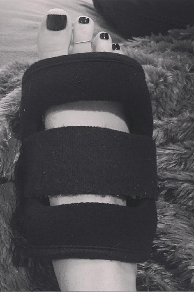 Rumer Willis' injured foot (c) Instagram