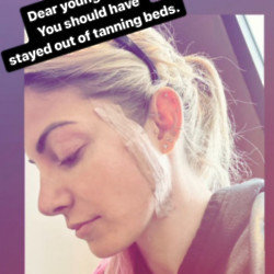 Alexa Bliss had cancerous cells removed (c) Instagram