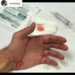 Alexander Skarsgard's hand (c) Alexander Skarsgard/Instagram