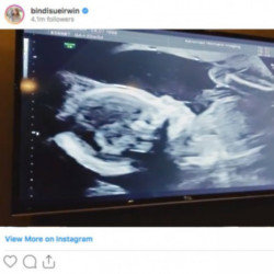 Bindi Irwin ultrasound (c) Instagram