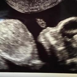 Blac Chyna's baby scan (c) Instagram