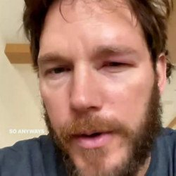 Chris Pratt was stung by a bee (c) Instagram