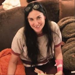 Demi Moore showing her lost tooth