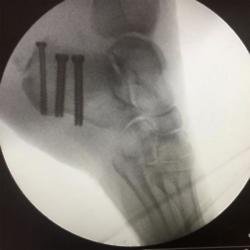 Gary Barlow's X-ray post (c) Twitter