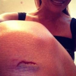 Jennifer Lopez' knee injury (c) Instagram