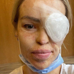 Katie Piper is back on TV days after being rushed to hospital for an emergency eye operation