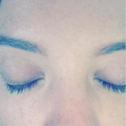 Lily Allen suffered minor burns and singed eyelashes (c) Instagram