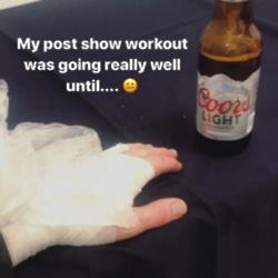 Nick Jonas injures hand (c) Instagram 