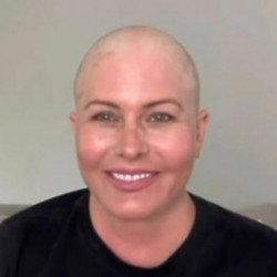 Nicole Eggert has shaved her head amid her cancer battle