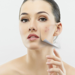 Do spots on your skin affect how you feel?