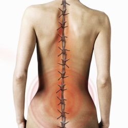 Are you taking advice on your back pain?