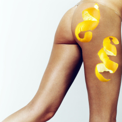 The majority of women suffer from orange peel on their legs
