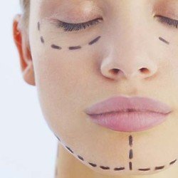 Every year, more and more people are getting cosmetic surgery