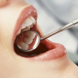 Looking After Your Mouth and Teeth Will Improve Your Dating Chance