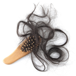Hair loss is usually a result of Chemotherapy