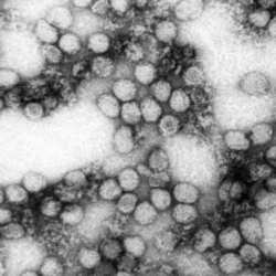 The virus has killed 10 people in the last six weeks