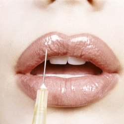 Would you get lip fillers for a fuller pout?