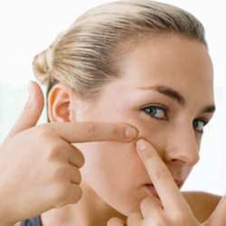 Stress is causing adult acne in some
