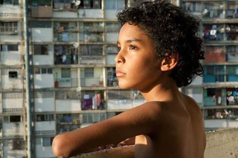 Pelo Malo