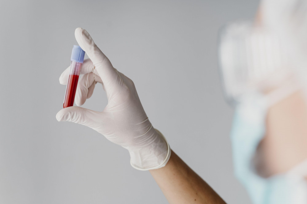 A blood test could revolutionise the diagnosis of Alzheimer's disease