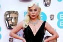 Lady Gaga could play Harley Quinn in the Joker sequel / Picture Credit: PA Images/Alamy Stock Photo
