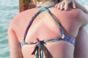 When was the last time you were sunburnt?
