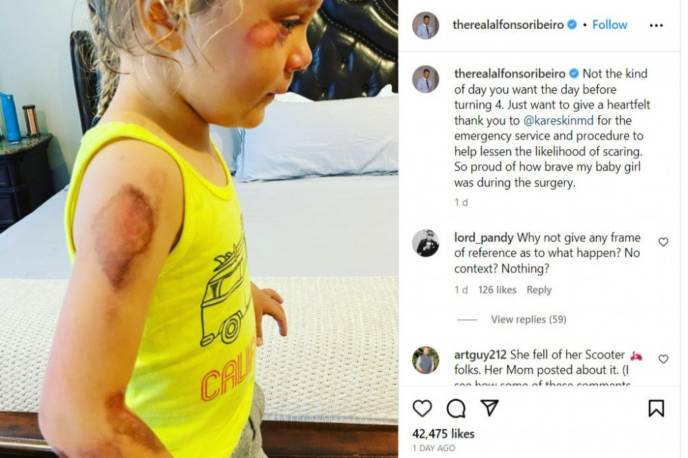 Alfonso Ribeiro's daughter was injured (c) Instagram