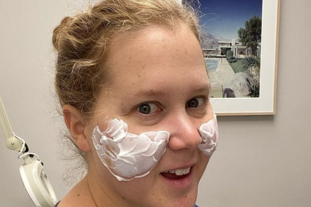 Amy Schumer gets cheek fillers removed