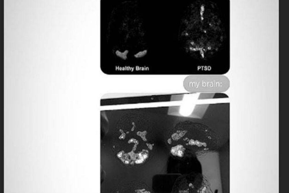 Ariana Grande's brain scans (c) Instagram