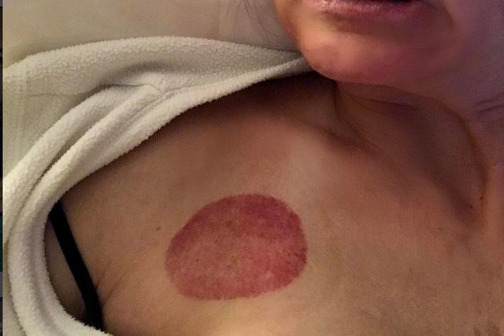 Debra Messing's pepperoni mark (c) Instagram 