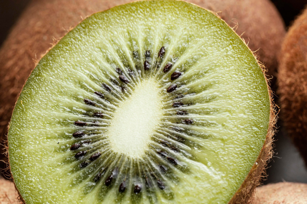 Eating kiwi fruit boosts mental health