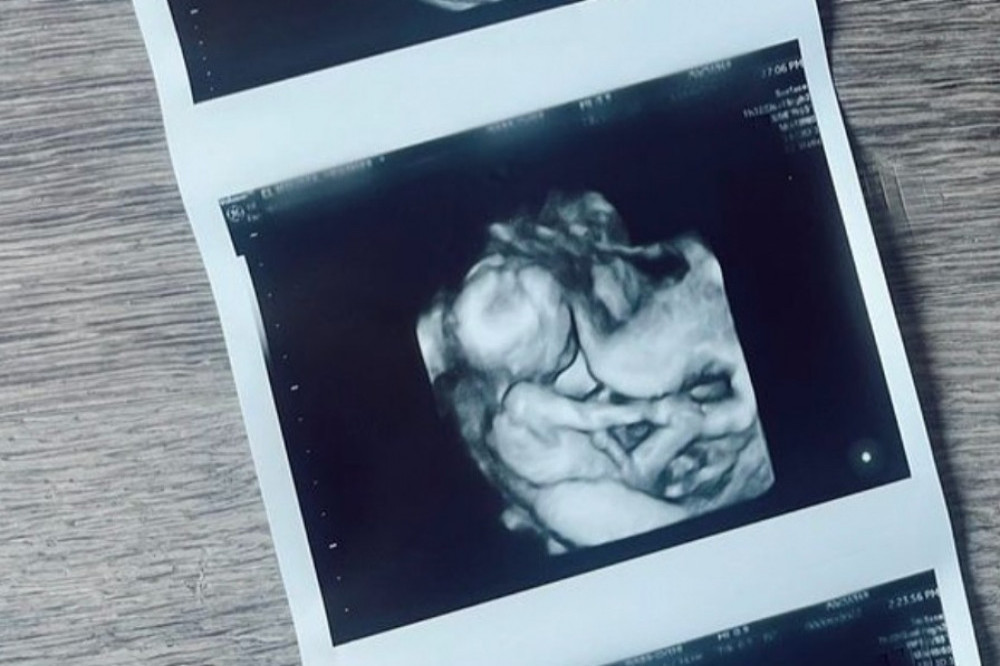 Heather Rae El Moussa shared a sonogram of her unborn son