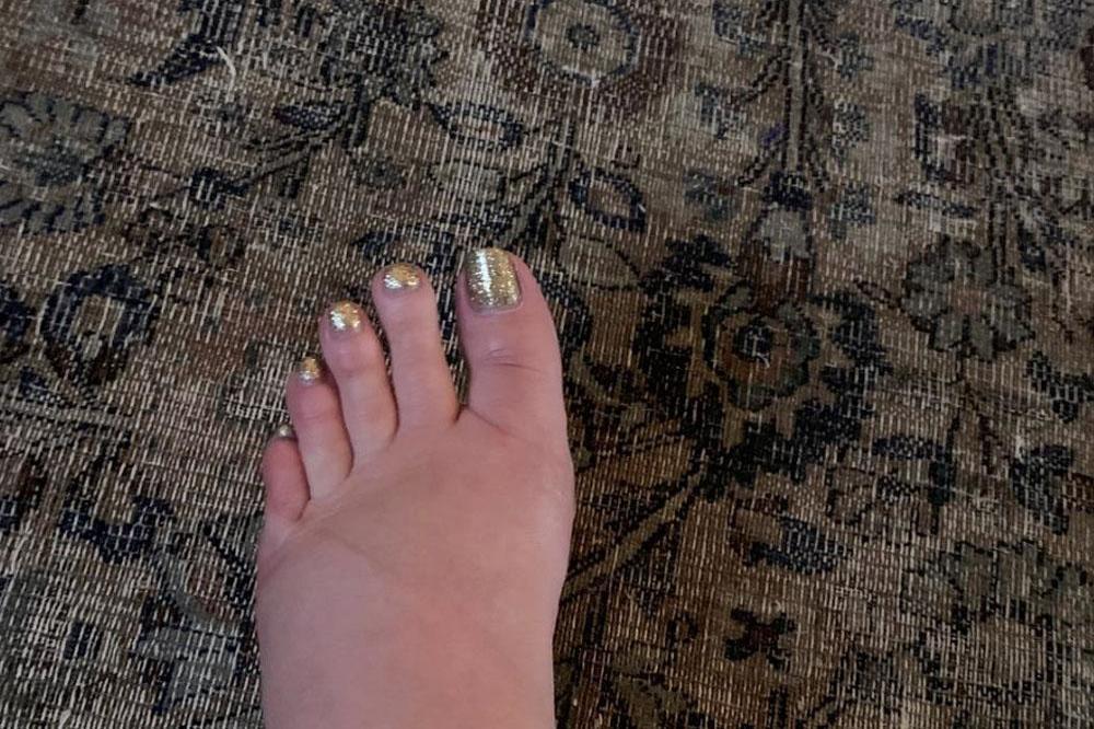 Jessica Simpson's swollen foot (c) Instagram 