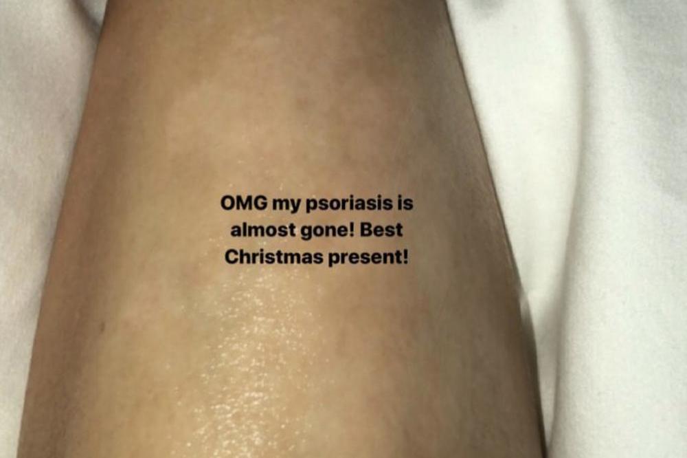Kim Kardashian West's leg (c) Instagram 