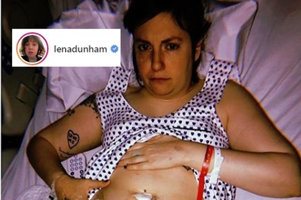 Lena Dunham (c) Instagram