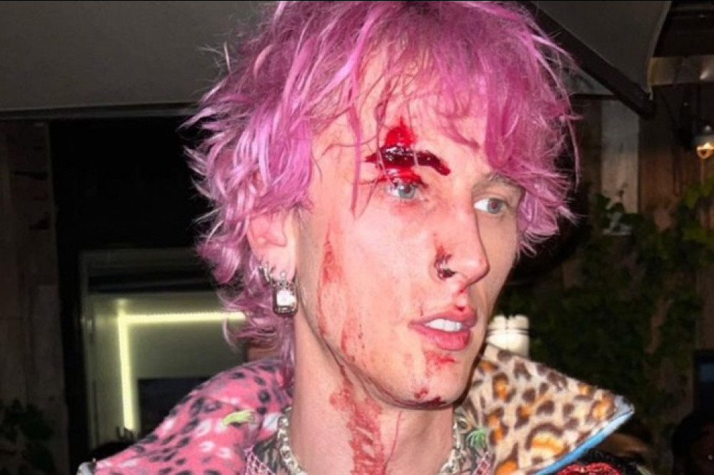 Machine Gun Kelly says he was left bloodied by a champagne flute after trying to clink it in a toast