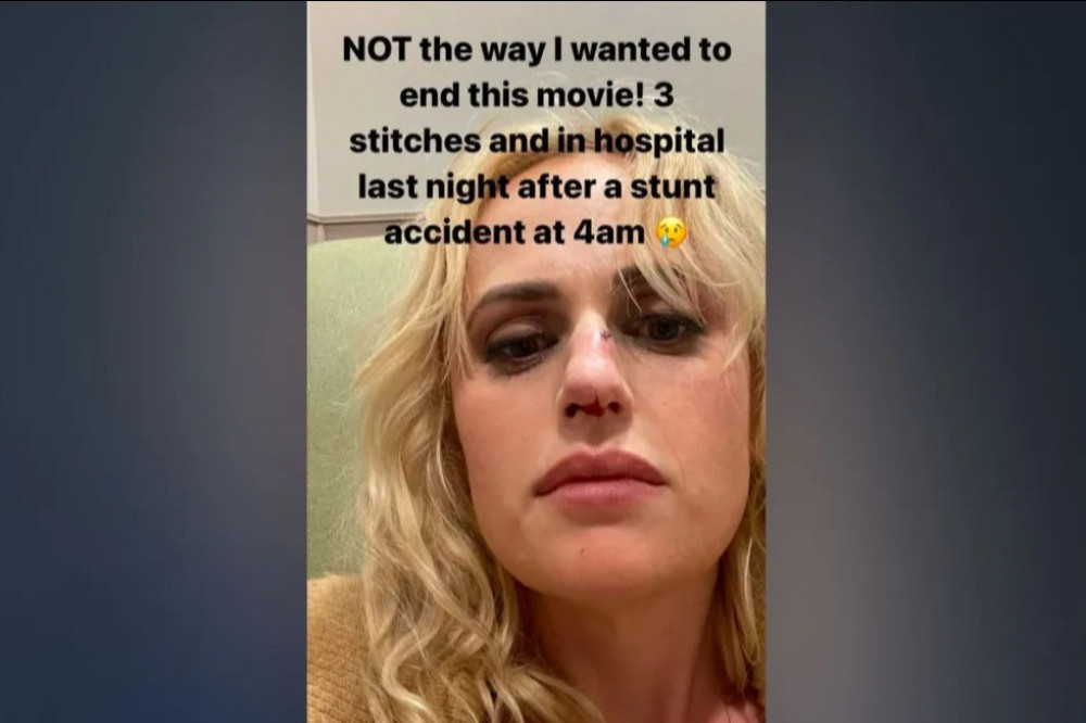 Rebel Wilson needed stitches (c) Instagram