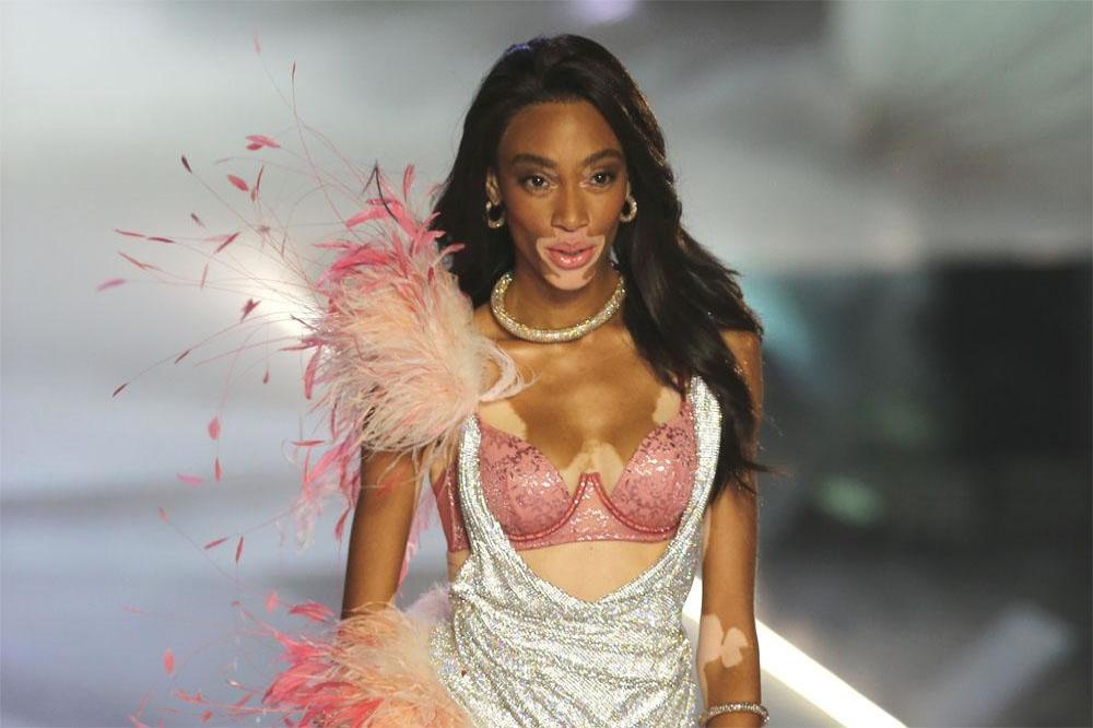 Winnie Harlow in the VS Show