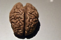 Obese people's brains are shaped in a different way