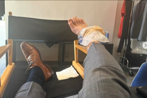 Chris Pratt has hurt his ankle (c) Instagram