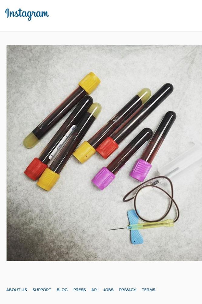 Kelly Osbourne's blood samples (c) Instagram