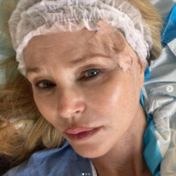 Christie Brinkley has been treated for skin cancer (c) Instagram