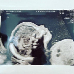 Christina Ricci's baby scan (c) Instagram
