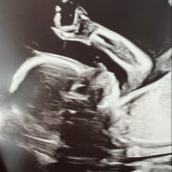 Hilaria Baldwin shares sonogram of baby number seven