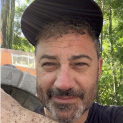 Jimmy Kimmel's burnt hair and eyebrows (c) Instagram