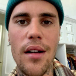 Justin Bieber is stricken with facial paralysis from Ramsay Hunt syndrome