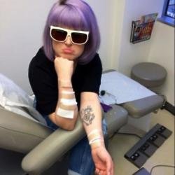 Kelly Osbourne having tattoo removal treatment